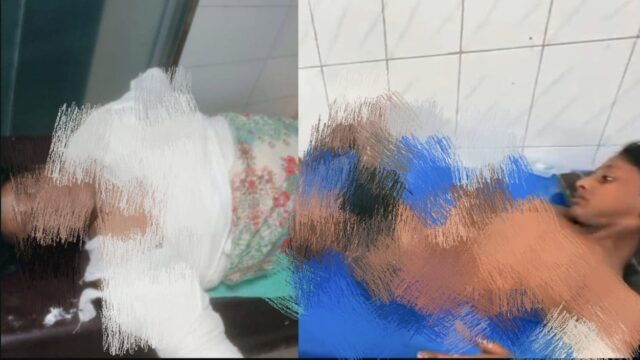 স্বামীর দেওয়া আগুনে দগ্ধ স্ত্রী-পুত্রের মৃত্যু